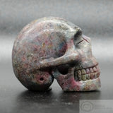 Ruby in Zoiste Human Skull (RZ01)
